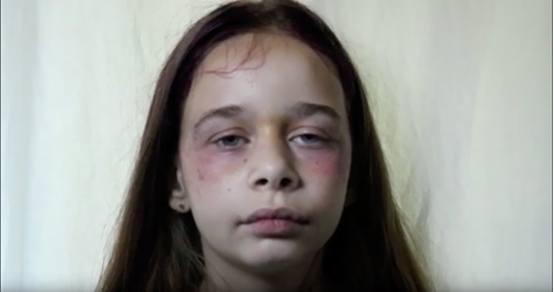 The Loop video still with close up view of a bruised face